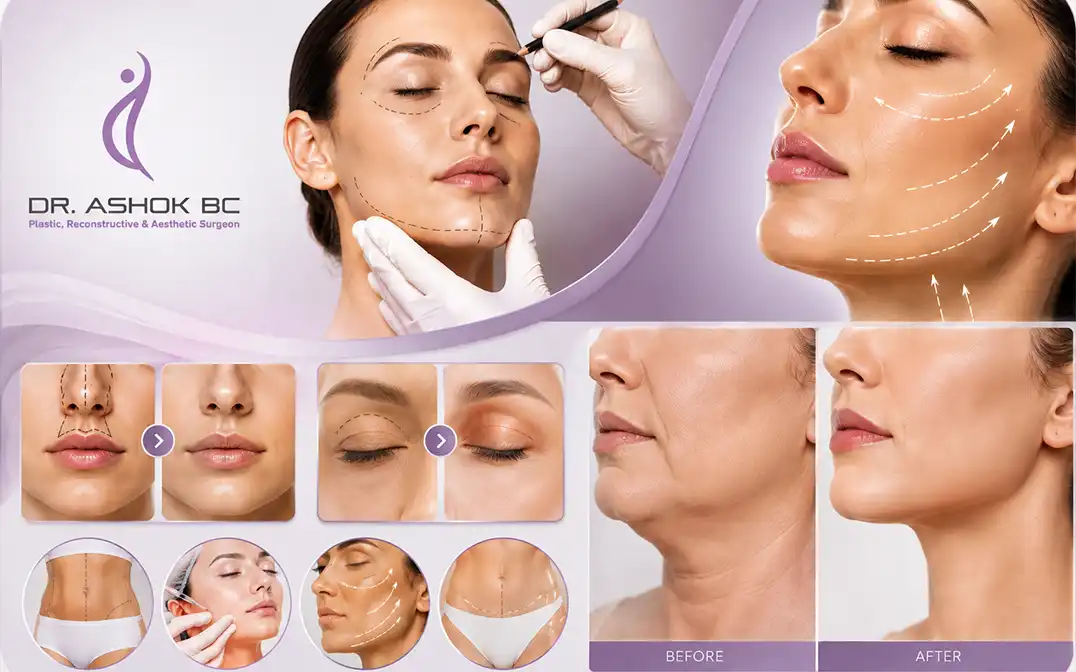 nose-surgery-in-Bangalore
